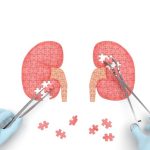 Un nuevo escáner PET podría detectar cáncer de riñón que otras pruebas no ven