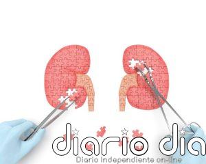 Un nuevo escáner PET podría detectar cáncer de riñón que otras pruebas no ven