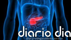 Cáncer de páncreas localizado: una prueba de sangre ultrasensible mejora la detección de enfermedad residual