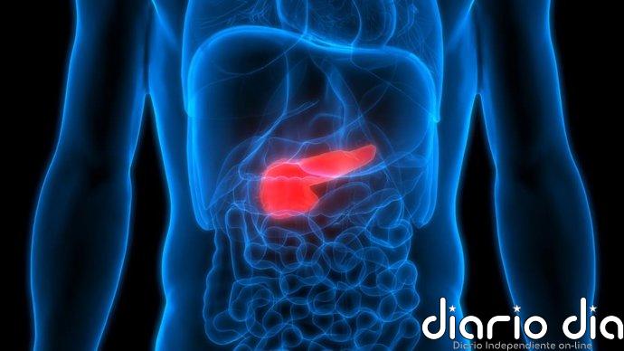 Cáncer de páncreas localizado: una prueba de sangre ultrasensible mejora la detección de enfermedad residual