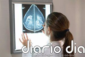 Descubren 81 genes que impulsan el cáncer de mama más agresivo