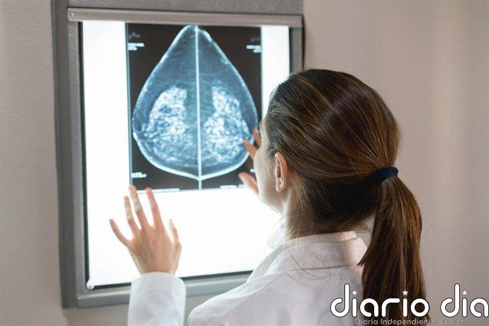 Descubren 81 genes que impulsan el cáncer de mama más agresivo