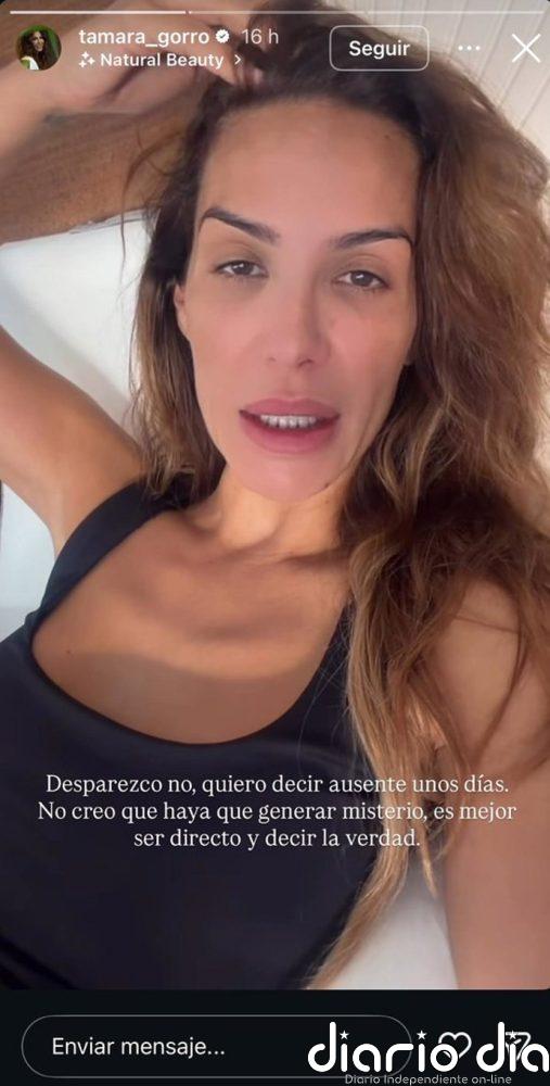 Tamara Gorro da la última hora sobre su estado tras su operación de urgencia: "No lo estoy llevando bien"