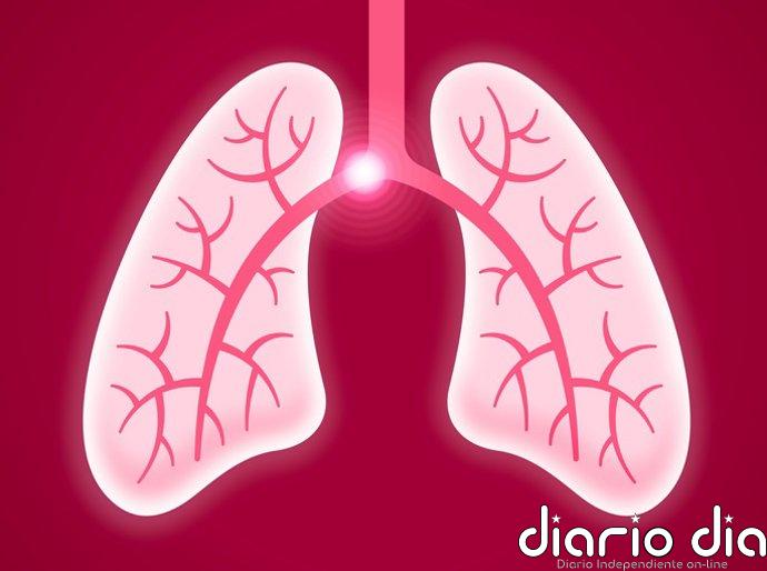 Un lenguaje único para salvar vidas: 7 sociedades médicas crean el estándar unificado para evaluar la embolia pulmonar