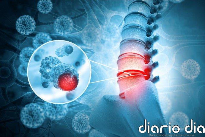 Una terapia con células madre da un paso clave para tratar la lesión medular crónica