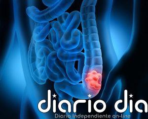 Una terapia ya aprobada contra otro cáncer podría mejorar el tratamiento del cáncer colorrectal avanzado