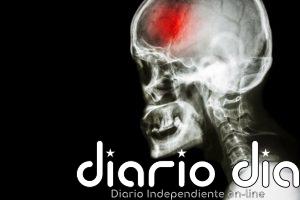 Avance contra el ictus: Rapamicina mejora la recuperación tras restablecer el flujo sanguíneo