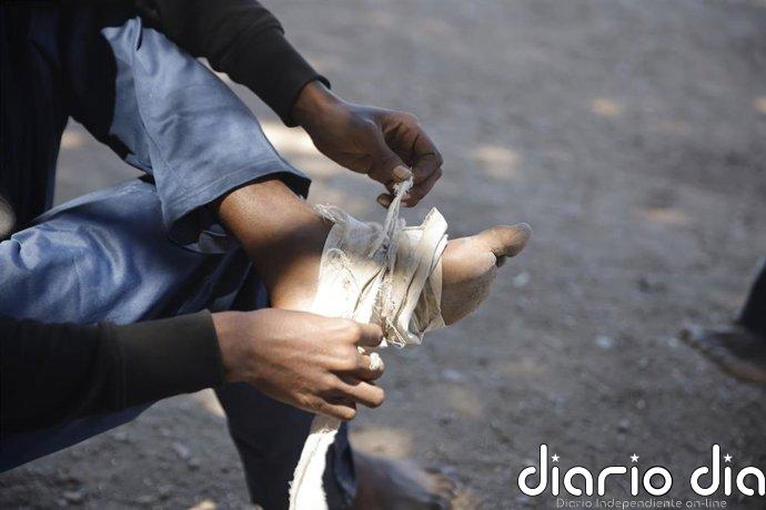 Ceuta cifra en 862 los menores migrantes acogidos en la ciudad, una "sobreocupación del 2.872%"