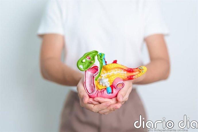 Clínica Mayo establece una estimación de riesgo de cáncer en pacientes con quistes pancreáticos
