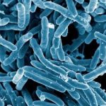 Descubren que un gen ya conocido de la tuberculosis se activa bajo estrés