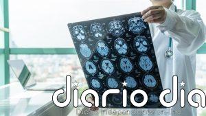 El cerebro podría repararse mejor de lo que se creía: descubren células capaces de reconstruir zonas dañadas