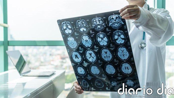 El cerebro podría repararse mejor de lo que se creía: descubren células capaces de reconstruir zonas dañadas