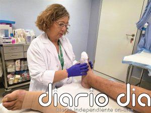Girona impulsa un modelo de atención al pie diabético para reducir amputaciones y evitar traslados