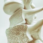 Identifican cómo la periodontitis puede agravar la osteoporosis a través de la microbiota intestinal
