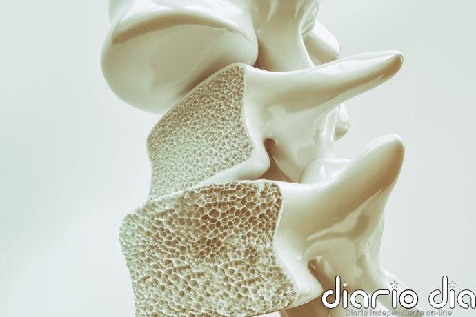 Identifican cómo la periodontitis puede agravar la osteoporosis a través de la microbiota intestinal