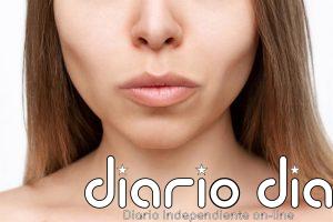 La 'cara Ozempic': el efecto de los medicamentos para adelgazar que está llenando las consultas de dermatología