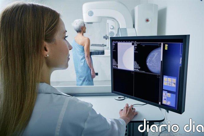 La cara y la cruz de una inmunoterapia dual preoperatoria prometedora en cáncer de mama HER2-negativo estadio temprano