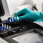 La UE destina 2,1 millones de euros a test PCR para la OMS contra el brote de ébola en RDC
