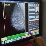 Las carencias de la clasificación estándar del cáncer de mama que pueden afectar al tratamiento