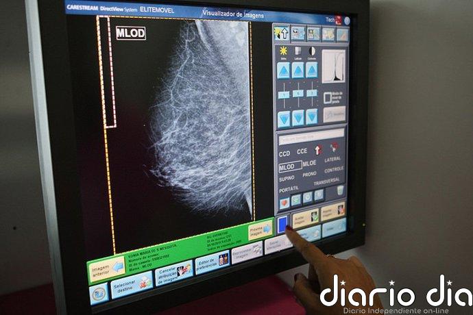 Las carencias de la clasificación estándar del cáncer de mama que pueden afectar al tratamiento
