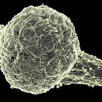 Uganda declara el final del brote de ébola tras 42 días sin contagios tras el alta del último paciente