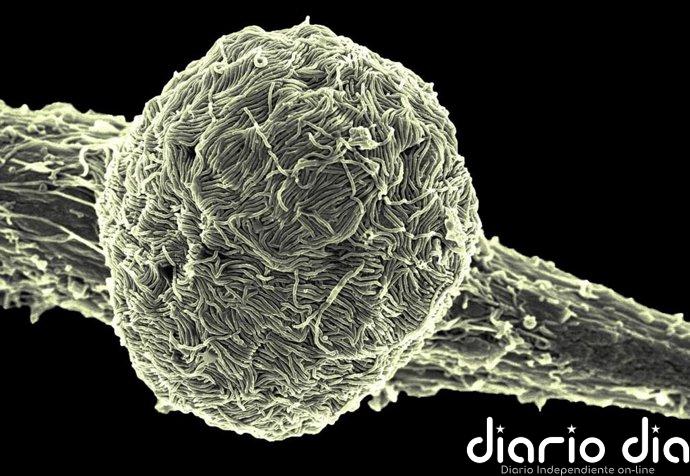 Uganda declara el final del brote de ébola tras 42 días sin contagios tras el alta del último paciente