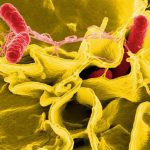 Un brote de salmonelosis en un local de Oviedo deja 25 afectados y 13 ingresados en el HUCA