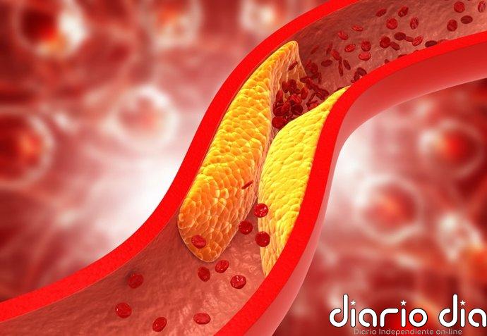 Un estudio muestra que el colesterol LDL elevado causó 3,6 millones de muertes en el mundo en 2023