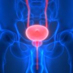 Un nuevo radiofármaco reduce un 28% el riesgo de progresión o muerte en pacientes con cáncer de próstata metastásico