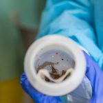Desarrollan un sistema con IA para detectar la enfermedad de Chagas en tiempo real en el móvil