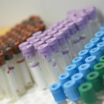 El IbSalut pone en marcha un programa para detectar el VIH y la hepatitis C en consultas rutinarias