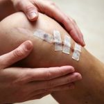 La fisioterapia mejora a corto plazo el dolor, la función y la fuerza tras una cirugía del ligamento cruzado anterior