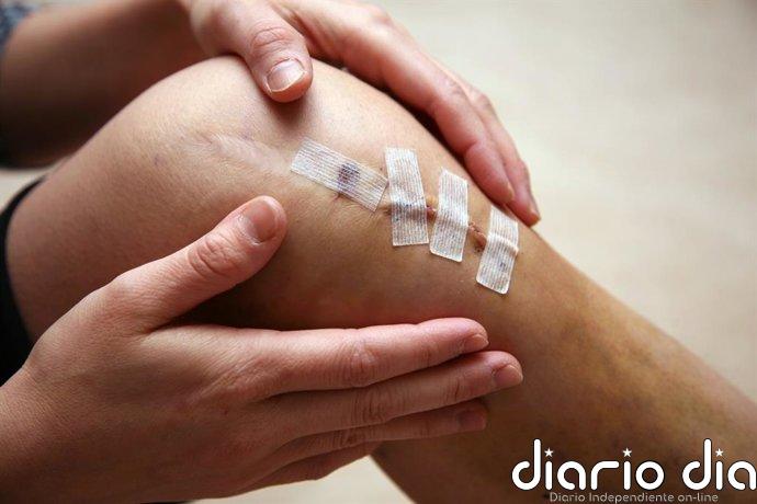 La fisioterapia mejora a corto plazo el dolor, la función y la fuerza tras una cirugía del ligamento cruzado anterior