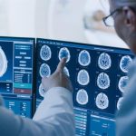 La SERAM reclama vías más ágiles para llevar la IA de la investigación en cáncer cerebral a la práctica clínica