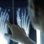 Los podólogos avisan: el climaterio dispara las patologías crónicas en los pies de las mujeres mayores de 60 años
