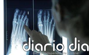 Los podólogos avisan: el climaterio dispara las patologías crónicas en los pies de las mujeres mayores de 60 años