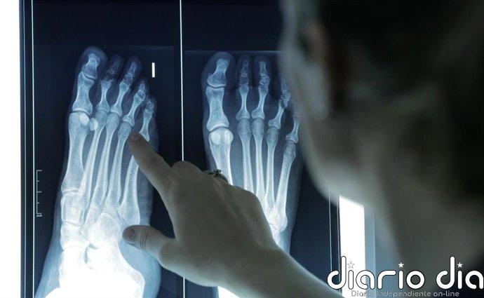 Los podólogos avisan: el climaterio dispara las patologías crónicas en los pies de las mujeres mayores de 60 años