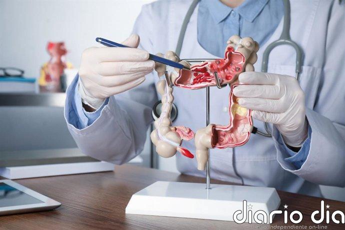 Los vasos sanguíneos del cáncer colorrectal podrían esconder una pista clave sobre la supervivencia