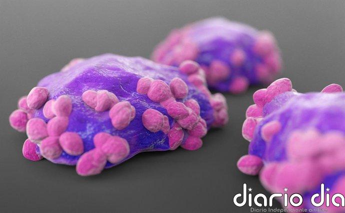Oncólogos destacan la transformación del abordaje de linfomas gracias a la inmunoterapia y tratamientos dirigidos