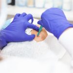 ¿Por qué tarda tanto el resultado de una biopsia Esto es lo que ocurre en el laboratorio