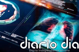 ¿Pueden los microplásticos contribuir al cáncer de pulmón? Un estudio encuentra estas párticulas en pacientes