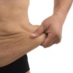 ¿Qué pasa con la piel después de perder muchos kilos? El reto del exceso de piel tras adelgazar