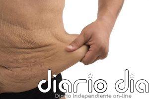 ¿Qué pasa con la piel después de perder muchos kilos? El reto del exceso de piel tras adelgazar