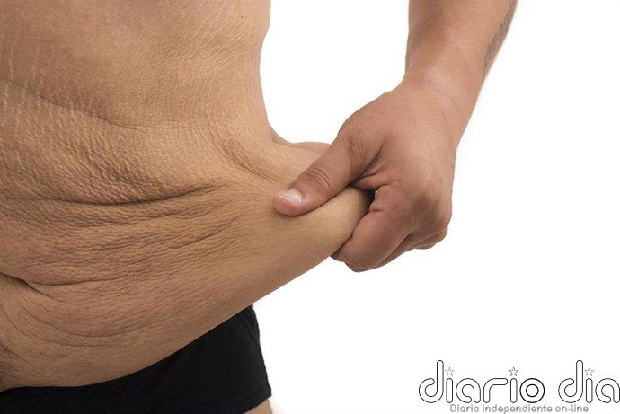 ¿Qué pasa con la piel después de perder muchos kilos? El reto del exceso de piel tras adelgazar