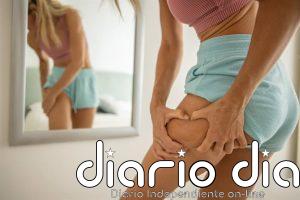 ¿Tus piernas no adelgazan aunque pierdas peso? Estas señales pueden indicar lipedema