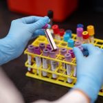 Un método de sangre seca permite detectar el ARN del Zika y la hepatitis C sin purificar la muestra
