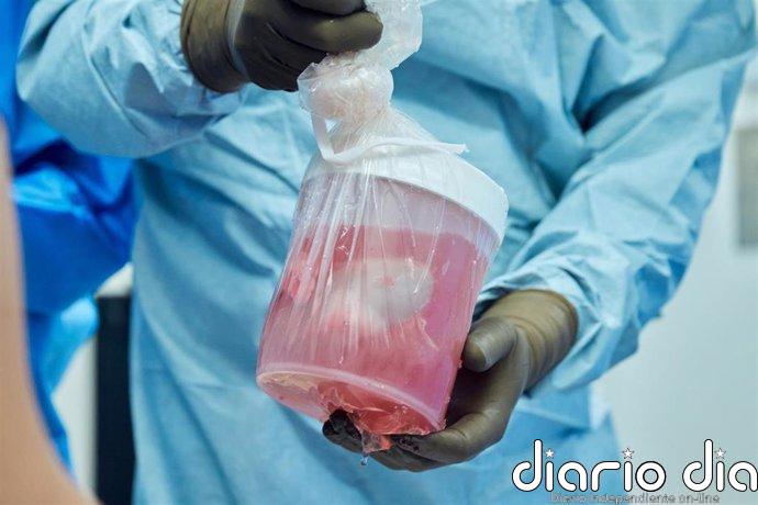 Un riñón de cerdo modificado genéticamente mantiene 271 días sin diálisis hasta recibir un trasplante humano