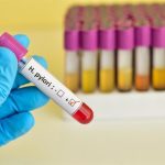 Una bacteria del estómago podría estar relacionada con 1 de cada 5 casos de cáncer colorrectal en el mundo