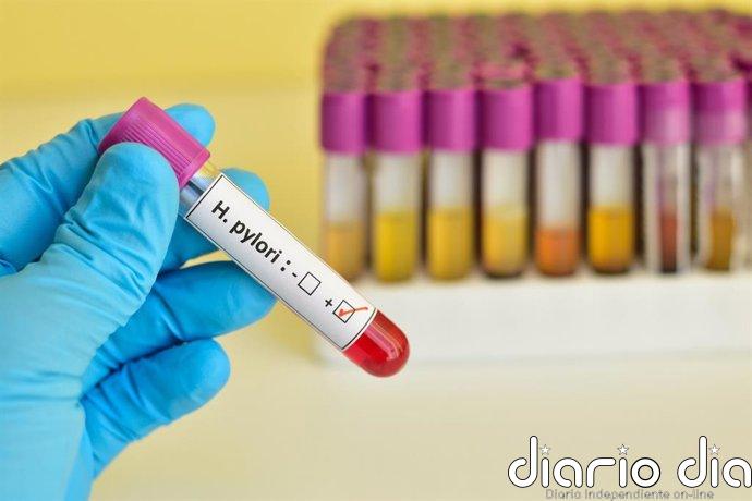 Una bacteria del estómago podría estar relacionada con 1 de cada 5 casos de cáncer colorrectal en el mundo