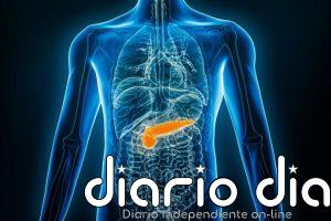 Una IA podría predecir el riesgo de cáncer de páncreas años antes del diagnóstico